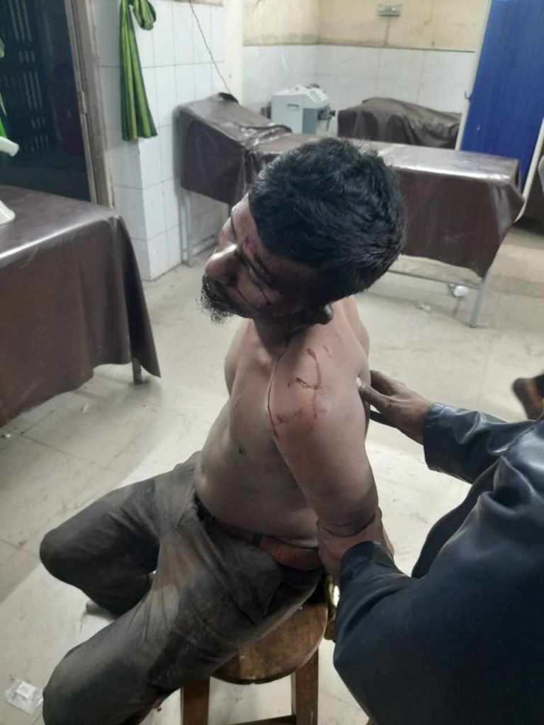 আড়াইহাজারে ডাকাত ছিনিয়ে নিয়ে হত্যার চেষ্টা, পুলিশ গ্রামবাসী সংঘর্ষে আহত ৫ 