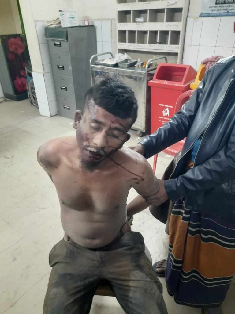 আড়াইহাজারে ডাকাত ছিনিয়ে নিয়ে হত্যার চেষ্টা, পুলিশ গ্রামবাসী সংঘর্ষে আহত ৫