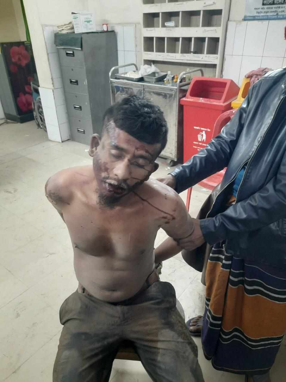 আড়াইহাজারে ডাকাত ছিনিয়ে নিয়ে হত্যার চেষ্টা, পুলিশ গ্রামবাসী সংঘর্ষে আহত ৫